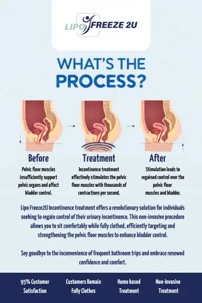 Diagram of how incontinence treatment Harlow works.