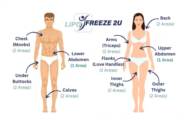 Areas you can have fat freezing treatment Harlow