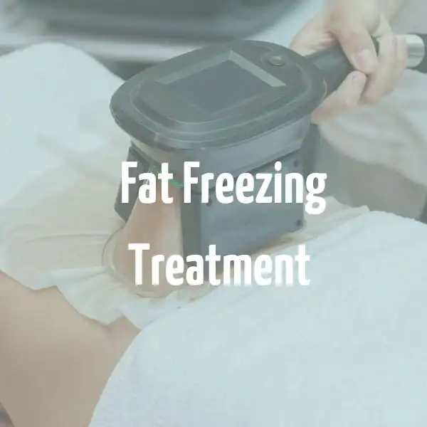 fat freezing treatment Harlow