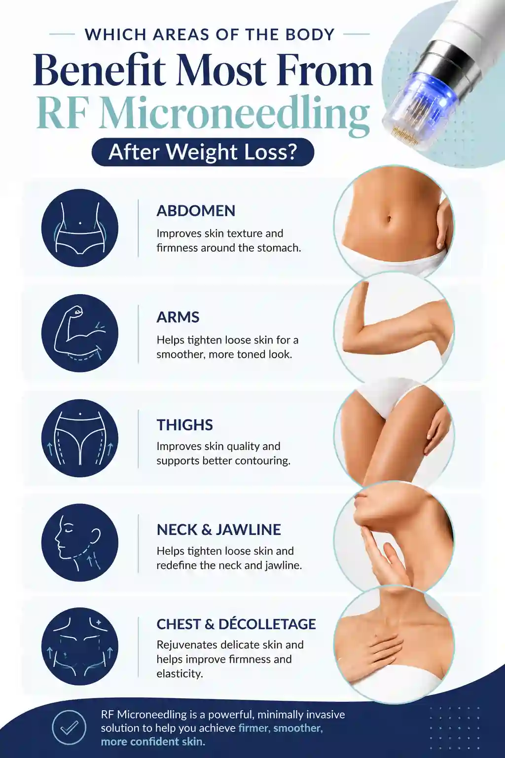 Which Areas of the Body Benefit Most From RF Microneedling After Weight Loss Harlow